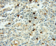 11080-1-AP - UBE2A / RAD6A