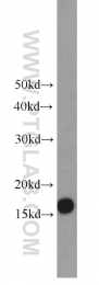 11080-1-AP - UBE2A / RAD6A