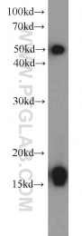 11080-1-AP - UBE2A / RAD6A