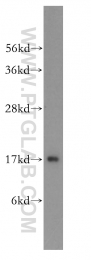 11373-1-AP - UBE2D1 / SFT
