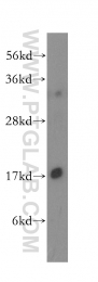 11373-1-AP - UBE2D1 / SFT