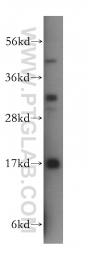 15475-1-AP - UBE2D4