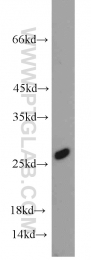 15488-1-AP - UBE2E3