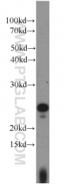 15488-1-AP - UBE2E3