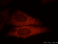 12012-1-AP - UBE2G1
