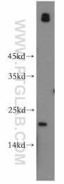 12012-1-AP - UBE2G1
