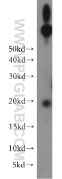 12012-1-AP - UBE2G1