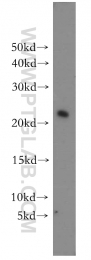 15685-1-AP - UBE2H