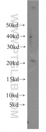 15685-1-AP - UBE2H