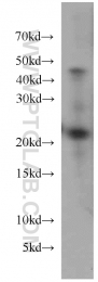15685-1-AP - UBE2H