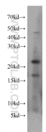 15685-1-AP - UBE2H