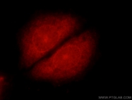 14837-1-AP - UBC9 / UBE2I