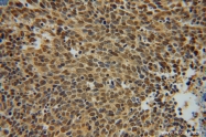 14837-1-AP - UBC9 / UBE2I