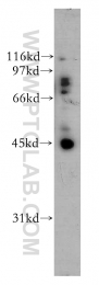 12581-1-AP - UBE2Q2