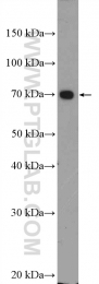 12333-1-AP - UBE3C