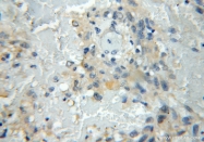 11564-1-AP - UBL7 / SB132