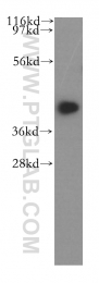 11564-1-AP - UBL7 / SB132