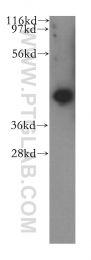 11564-1-AP - UBL7 / SB132
