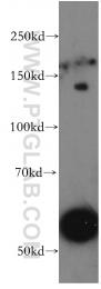 20363-1-AP - Ubinuclein-1 (UBN1)