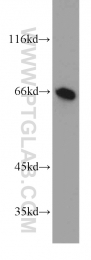 13856-1-AP - UBP1 / LBP1