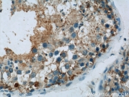 23449-1-AP - Ubiquilin-2 (UBQLN2)