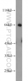 23449-1-AP - Ubiquilin-2 (UBQLN2)