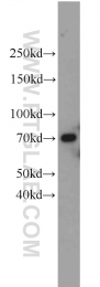 23449-1-AP - Ubiquilin-2 (UBQLN2)