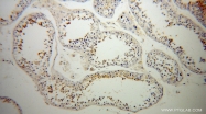 13568-1-AP - Ubiquilin-3 (UBQLN3)