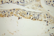 13568-1-AP - Ubiquilin-3 (UBQLN3)