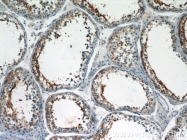 23372-1-AP - Ubiquilin-3 (UBQLN3)