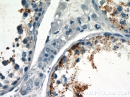 23372-1-AP - Ubiquilin-3 (UBQLN3)