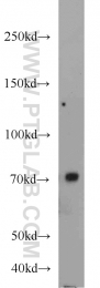 23372-1-AP - Ubiquilin-3 (UBQLN3)