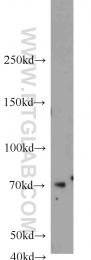 23372-1-AP - Ubiquilin-3 (UBQLN3)