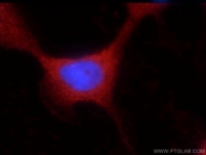 16400-1-AP - Ubiquilin-like protein