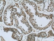16400-1-AP - Ubiquilin-like protein