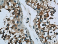 16400-1-AP - Ubiquilin-like protein