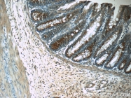 16400-1-AP - Ubiquilin-like protein
