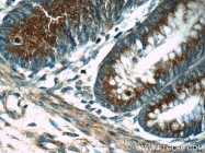 16400-1-AP - Ubiquilin-like protein