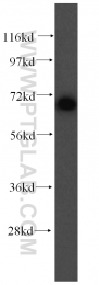 16400-1-AP - Ubiquilin-like protein
