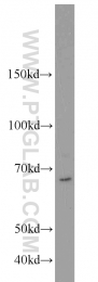 18853-1-AP - UBR2