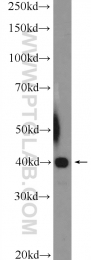 26062-1-AP - UBXN10 / UBXD3