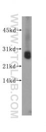 14730-1-AP - UCHL1 / PGP9.5