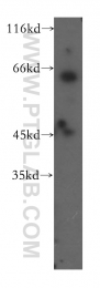 17005-1-AP - UCKL1