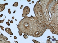 12198-1-AP - Urocortin-2 (UCN2)