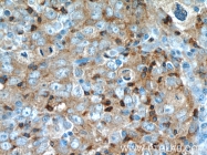 17982-1-AP - UGT8 / UGT4