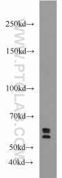 17982-1-AP - UGT8 / UGT4