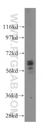 17982-1-AP - UGT8 / UGT4
