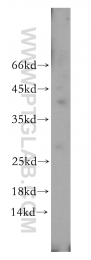 17715-1-AP - ULBP1 / NKG2D ligand 1