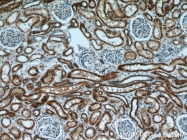 11911-1-AP - Uromodulin (UMOD)