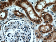 11911-1-AP - Uromodulin (UMOD)